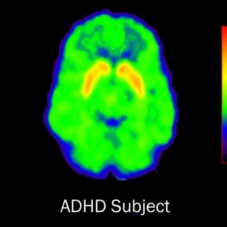 Логотип @adhdsdvg - SDVG(ADHD), Blackpill, Science && Shitposting