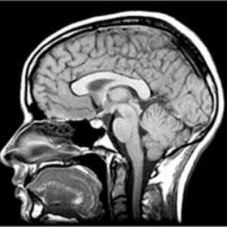 Логотип @adultneuroradiology - NEUROIMAGING/NEURORADIOLOGY