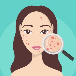 Логотип @akne_roa - ПОМОЩНИК В ЛЕЧЕНИИ АКНЕ