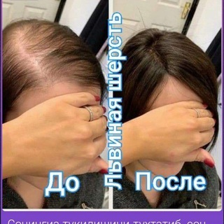 Логотип @bonusniy22 - Tukilgan sochlarni qayta tiklash