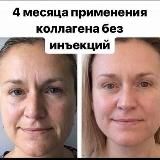 📸 ОТЗЫВЫ❗️20 / КОЛЛАГЕН/ ТРИНИТИ / пептидный / морской COLLAGEN NL фото/ отзывы 🔴