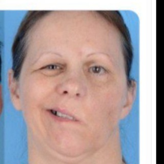 Логотип @corona_impfschaden - 🦠❌Corona_Impfschaden_Nebenwirkungen🦠❌