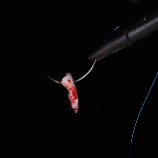 Логотип @docshabnam - Имплантация как искусство ☺️