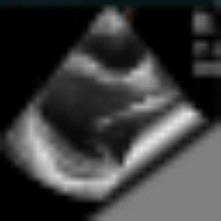 Логотип @doctor_soft_echo_news - Эхокардиографические вести