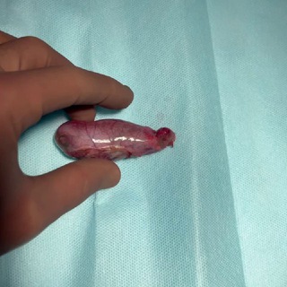 Логотип @dr_gallbladerdisease - Заболевания жёлчного пузыря