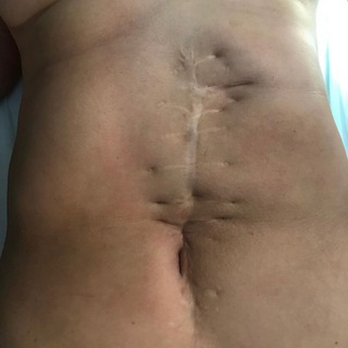 Логотип @dr_hernia - Грыжи