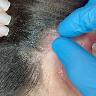 Логотип @dr_softtissueneoplasms - Заболевания мягких тканей