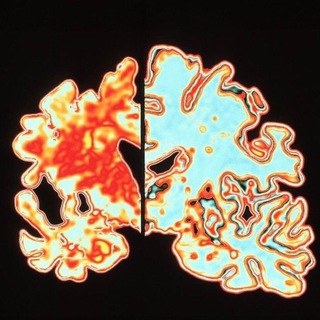 Логотип @eazy_neurology_chat - eazy_neurology🧠 Chat