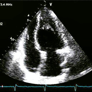 Логотип @echocardiographist - Эхокардиография/Кардиология/Echocardiography/Cardiology🫀👨‍⚕