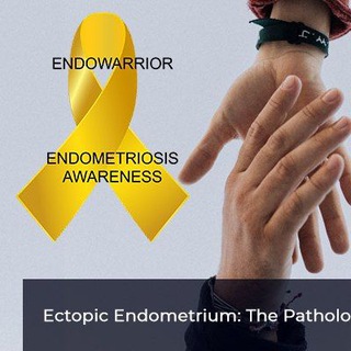 Логотип @endopodderzhka - Про эндометриоз