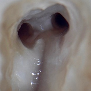 Логотип @endostatham - МыслиВслух