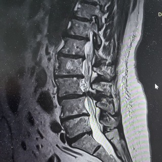 Логотип @fibulaaaaa - FIBULAAA🧠