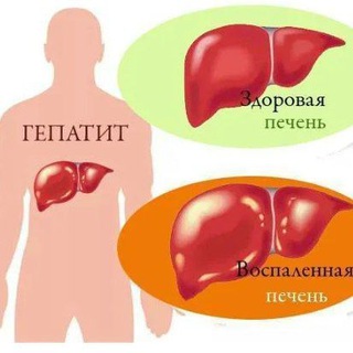 Логотип @hatesquadd - Гепатит С