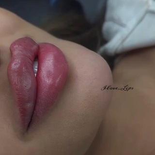 Логотип @ilove_lips - Косметолог • Увеличение губ • ilove_lips