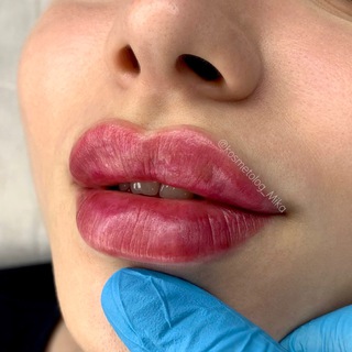 Логотип @kosmetolog_mika_chat - Kosmetolog_Mika