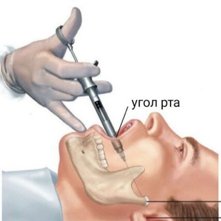 Логотип @mandibularka - Мандибулярка💉