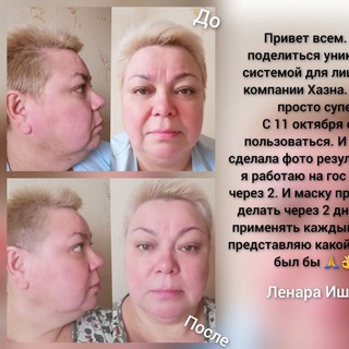 Логотип @maskasharm - 💥РЕЗУЛЬТАТЫ ПО ЛИФТИНГ-СИСТЕМЕ "SHARM"💥