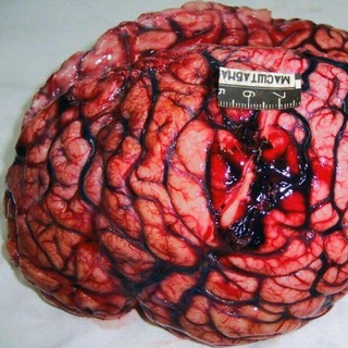 Логотип @medecine5 - Медицина 18 +