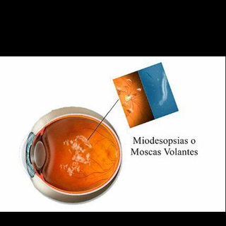 Логотип @miodesopsias - miodesopsias - moscas volantes