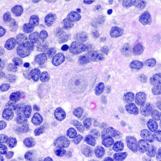 Логотип @neuropathcore - neurofun🧠