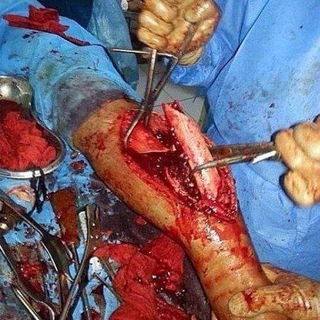 Логотип @ochiq_tibbiyot - OCHIQ TIBBIYOT 18+ || МЕДИЦИНА БЕЗ ЦЕНЗУРЫ