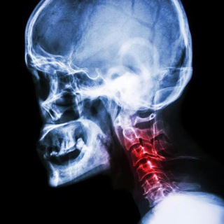 Логотип @osteohondrozhealth - Шейный остеохондроз