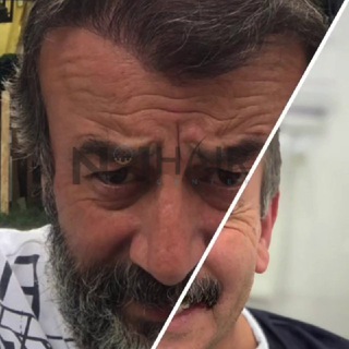 Логотип @peresadkavolosufa1 - Пересадка волос г.Уфа