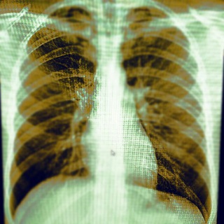 Логотип @radiologymmachat - Radiology/Рентгенология Чат