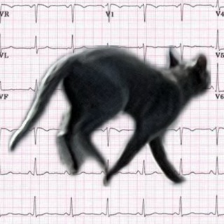 Логотип @restless_ecg - Плёночка неспокойная