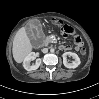Логотип @shortradiology - Radiology short cases