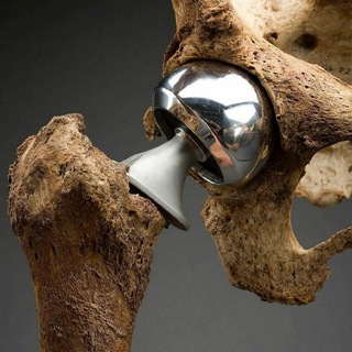 Логотип @traumaclub - Травматология и ортопедия