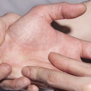 Логотип @treskhlopka - в холодных руках