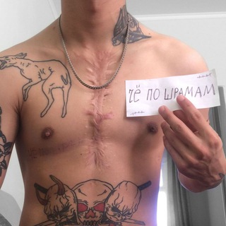 Логотип @tvoishrami - че по шрамам