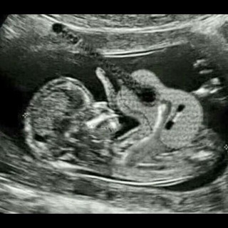 Логотип @ultrasounduzbek - Ultrasound.Uz. -Биргаликда курашамиз! Биргаликда енгамиз!