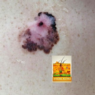 Логотип @vasha_kozhka - Дерматология. Полезное