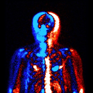 Логотип @warburg_effect - Не радиация