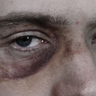 Логотип @xxxzell - наркоман.