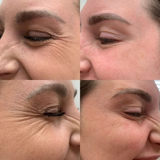 Логотип @zara_lashes - Kosmetolog_zaraa
